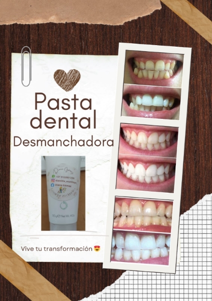 Imagen de PASTA DENTAL DESMANCHADORA